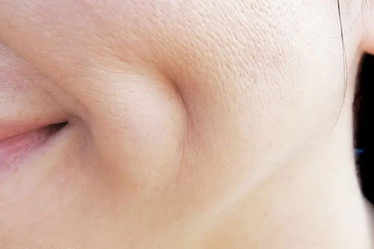Tips Mengecilkan Pori-pori, Salah Satunya Sering Cuci Muka Sebelum Tidur