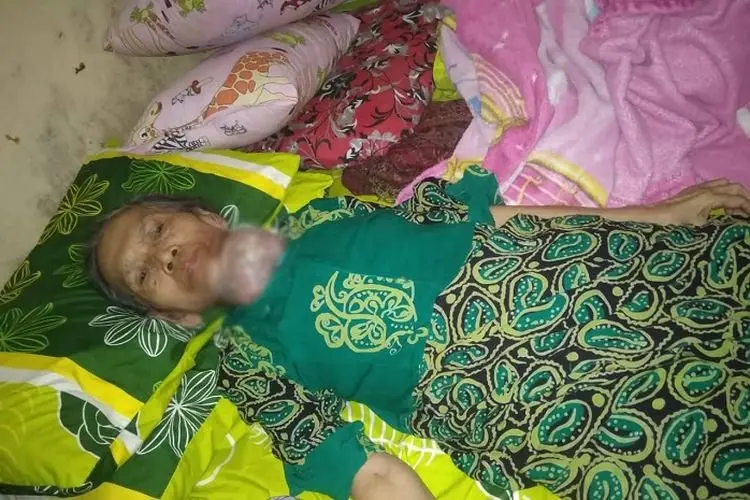Nenek Asal Banjaran Sedang Berjuang Melawan Kanker Tiroid, Sehari-hari Hanya Terbaring Lemah...
