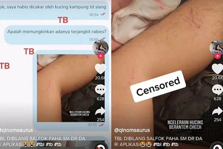 Gara-gara Kakinya Putih Banget, Dokter Ini Dihujat Netizen