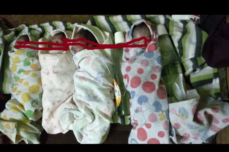 Begini Kronologi Lahirnya Empat Bayi Kembar di KBB, Dua Meninggal Dunia