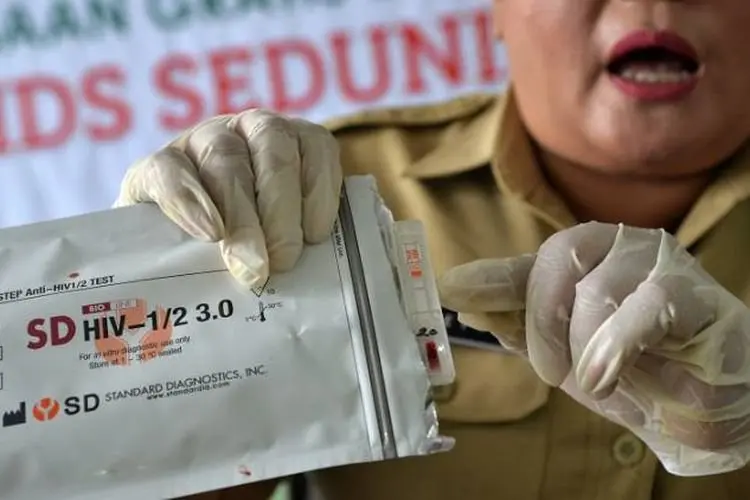 Ratusan Napi Lapas Narkotika Cirebon Jalani Screening HIV AIDS