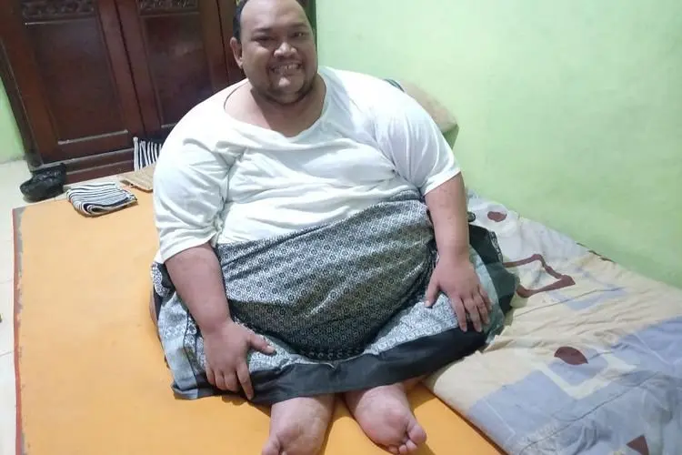 Bobotnya  Sampai 260 Kg, Singgih Butuh Donasi Gubernur Jabar Buat Operasi Lemak