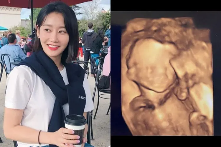 Gummi eks Crayon Pop Umumkan Kehamilan Anak Keduanya: Bagaimana Saya akan Membesarkan Dua Anak?
