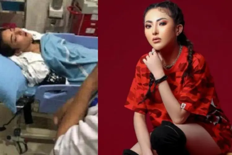 Ayu Aulia Coba Bunuh Diri, Polisi Temukan Bercak Darah di Kamar Apartemennya