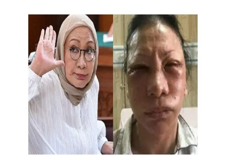 Ratna Sarumpaet Ceritakan Alasan Sebarkan Berita Bohong Soal Wajahnya yang Dianiaya hingga Babak Belur
