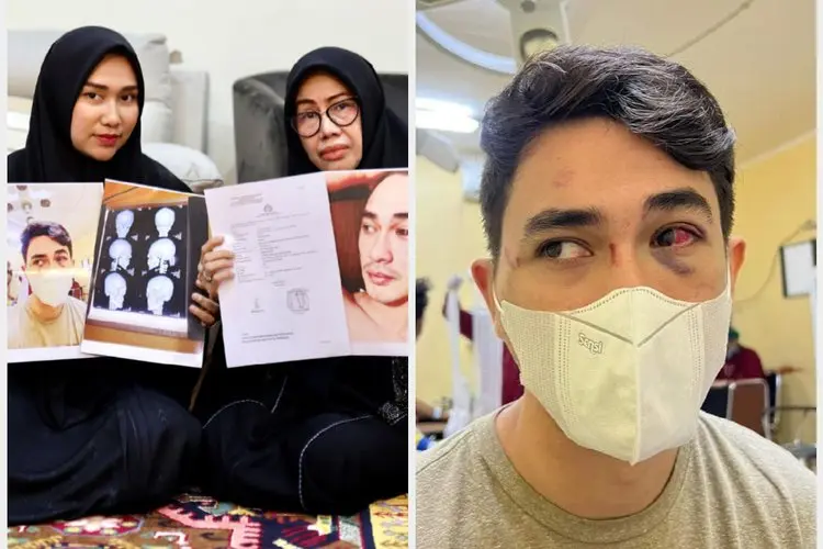Dikeroyok dan Hampir Buat Anaknya Meregang Nyawa, Ibunda Rico Valentino Minta Keadilan