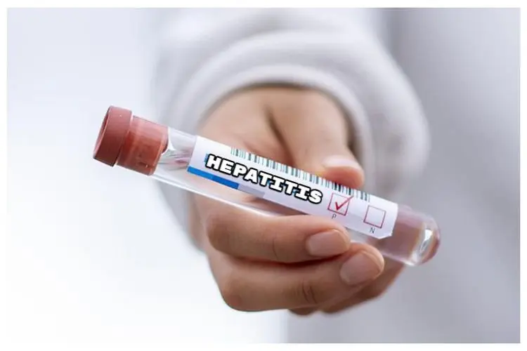 Waspada! Hepatitis Akut Bisa Menular Lewat 2 Hal Ini