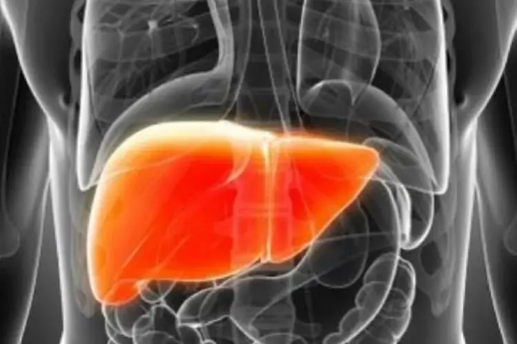  Dokter Ungkap Gejala Awal Hepatitis Pada Anak