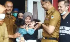 Bayi Kembar Siam di Cipada KBB Siap Operasi Pemisahan, Ketua Tim Dokter RSHS Jelaskan Kondisinya 
