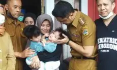Operasi Pemisahan Bayi Kembar Siam di Cipada KBB Terkendala Biaya, Hengky Sebut Kekurangannya Rp220 Juta