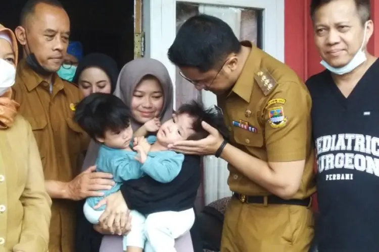 Operasi Pemisahan Bayi Kembar Siam di Cipada KBB Terkendala Biaya, Hengky Sebut Kekurangannya Rp220 Juta