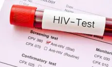 Gawat, Dinas Kesehatan Bandung Barat Catat HIV AIDS 2022 Capai 139 Kasus
