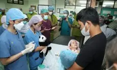 Kabar Baik, Bayi Kembar Siam Ayesha Azalea Putri Emira dan Aleeya Azalea Putri Emira Dioperasi Pagi Ini