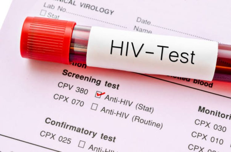 Gawat, Dinas Kesehatan Bandung Barat Catat HIV AIDS 2022 Capai 139 Kasus
