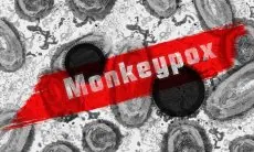 Kasus Monkeypox Ditemukan di Bandung, Dinkes :  Belum Terdeteksi di Cimahi