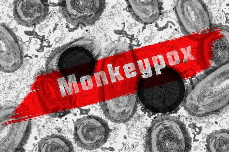 Kasus Monkeypox Ditemukan di Bandung, Dinkes :  Belum Terdeteksi di Cimahi