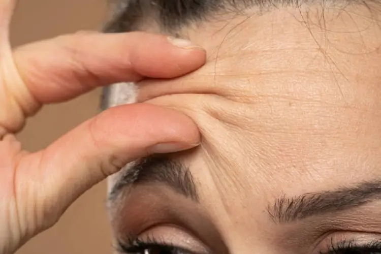 5 Tips Perawatan Kulit Alami untuk Hilangkan Kerutan di Dahi dan Cegah Penuaan Dini