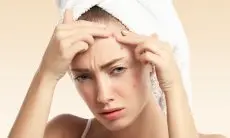 Kulit Berjerawat Bikin Gak PD? 5 Skincare Lokal Ini Dijamin Ampuh Bikin Wajah Mulus Bebas Jerawat!