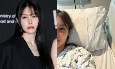 Setelah Operasi Wajah Park Gyu Ri Kara Hadapi Komentar Jahat