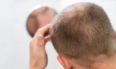 7 Cara Diagnosis dan Tips untuk Mencegah Rambut Rontok 