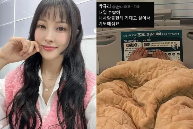 Jelang Comeback Kara, Park Gyu Ri Harus Jalani Operasi Setelah Patah Tulang Pipi