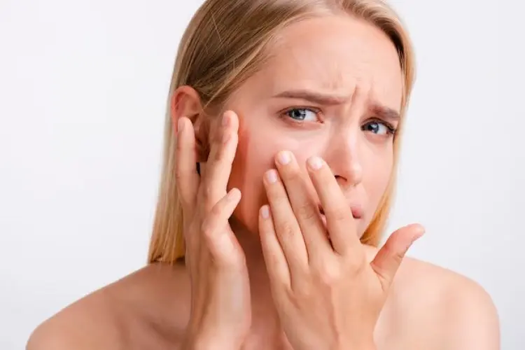 Kulit Kering Bukan Lagi Masalah! 6 Tips Jitu Memilih Skincare yang Cocok, Wajah Cerah dan Bebas Kemerahan!