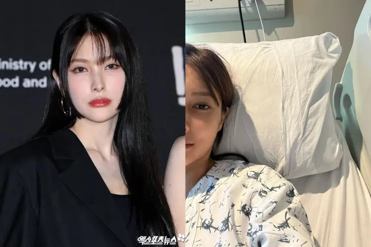 Setelah Operasi Wajah Park Gyu Ri Kara Hadapi Komentar Jahat