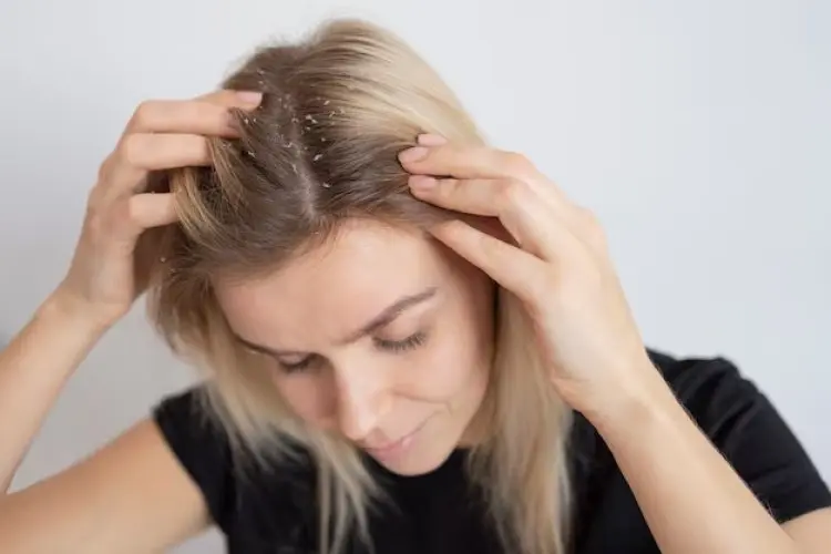 Tips Perawatan Kulit Kepala, Rahasia agar Rambut Tipis Kembali Bervolume dan Sehat 