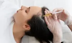 Bukan Hanya untuk Jerawat, Tretinoin Bisa Bermanfaat Bagi Pertumbuhan Rambut