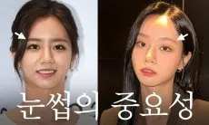 Hyeri Tanggapi Rumor Dirinya Lakukan Operasi Plastik: Saya Melakukannya Setelah...