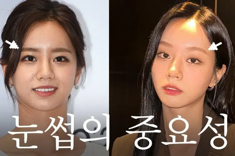 Hyeri Tanggapi Rumor Dirinya Lakukan Operasi Plastik: Saya Melakukannya Setelah...