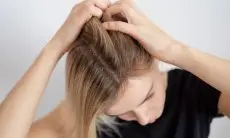 5 Solusi Alami untuk Mengatasi Kulit Kepala Berminyak dengan Mudah