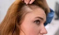 8 Kesalahan yang Memicu Rambut Rontok dan Cara Menghindarinya