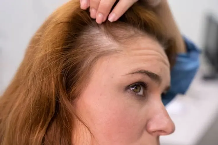 8 Kesalahan yang Memicu Rambut Rontok dan Cara Menghindarinya