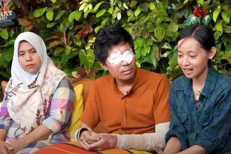 Usai Laporkan Novi ke Polisi, Muncul Petisi Tuntut Pencabutan Donasi untuk Agus Salim Korban Penyiraman Air Keras