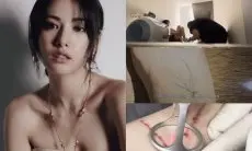 Nana Ceritakan Kisah Menyakitkan saat Dia Harus Menghapus Tato di Seluruh Tubuhnya