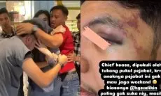 Bukan Sopir, Identitas Sosok yang Pukul Dokter Koas di Palembang Ternyata Honorer di KemenPUPR Sumsel