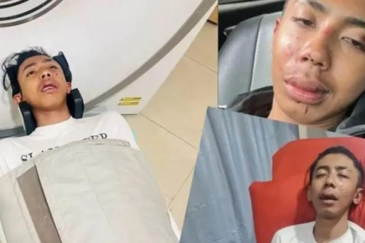Miris, Bandung Suram Lagi Usai Mahasiswa jadi Korban Penganiayaan Salah Sasaran Oknum Anggota Klub Moge
