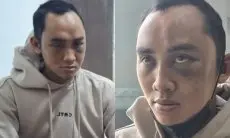 Kronologi ASN di Bandung Barat Jadi Korban KDRT Istri hingga Wajahnya Babak Belur