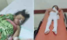 Tak Dapat Bantuan Pemerintah, Kuli di Toko Sembako Asal Cipeundeuy KBB Ini Berjuang Sendiri Demi Kesehatan Anaknya yang Tersambar Petir
