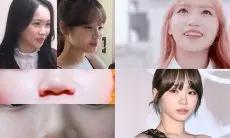 Hidung Terlihat Lebih Mancung, Kim Chaewon LE SSERAFIM Diduga Operasi Plastik