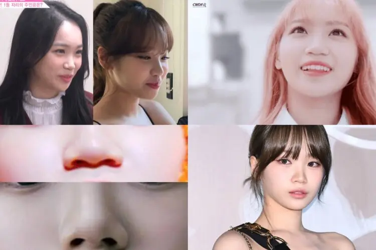 Hidung Terlihat Lebih Mancung, Kim Chaewon LE SSERAFIM Diduga Operasi Plastik