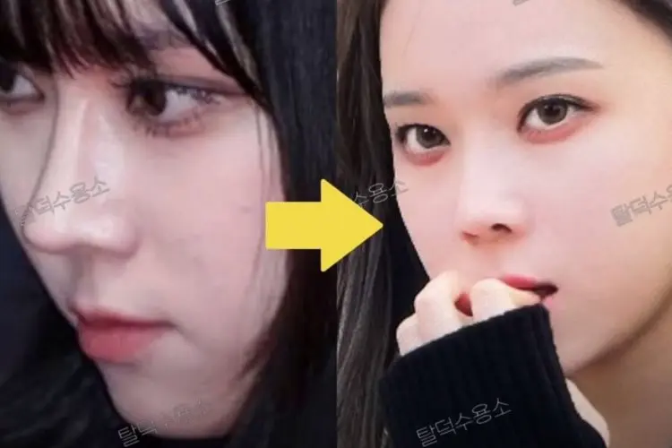Hidung Winter aespa Dinilai Kembali Berubah, Diduga Hilangkan Implan Silikon