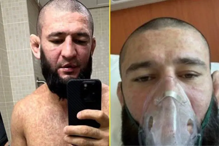Dricus du Plessis Sebut Khamzat Chimaev Bakal Kabur dari UFC 319, Nassourdine Imamov Gantinya!