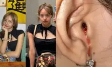 Lisa BLACKPINK Bagikan Foto Cedera Telinga Penuh Darah, Penggemar Ungkap Rasa Khawatir