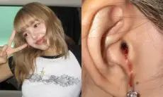 Lisa BLACKPINK Tanggapi Khawatirkan Penggemar Soal Cedera Telinga hingga Berdarah