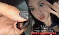 Unggah Foto Cedera Kuku, Lee Young Ji Malah Kehilangan 4.000 Followers Instagram