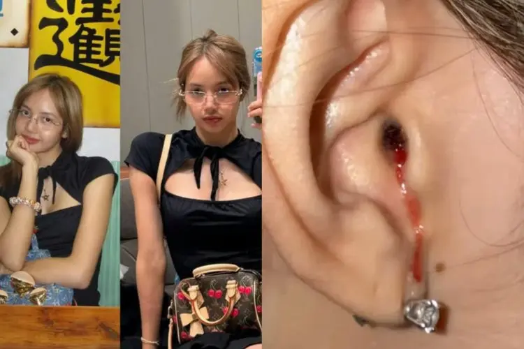 Lisa BLACKPINK Bagikan Foto Cedera Telinga Penuh Darah, Penggemar Ungkap Rasa Khawatir