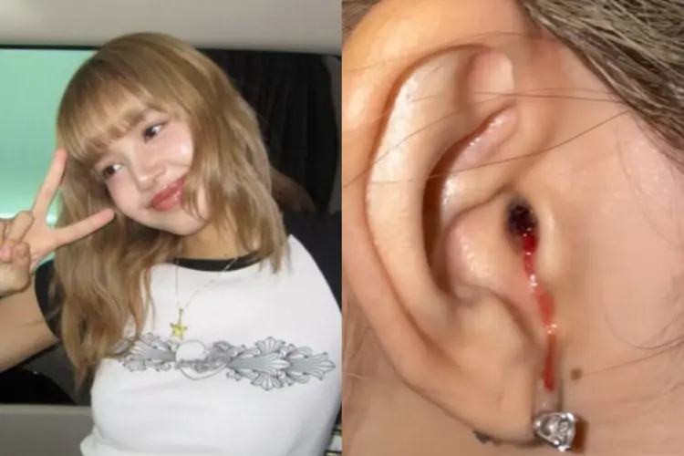 Lisa BLACKPINK Tanggapi Khawatirkan Penggemar Soal Cedera Telinga hingga Berdarah
