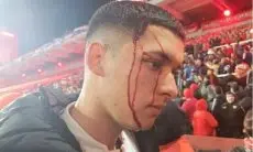 Begini Kronologis Kerusuhan Independiente vs Universidad de Chile, Penonton Ditelanjangi dan Dipukul